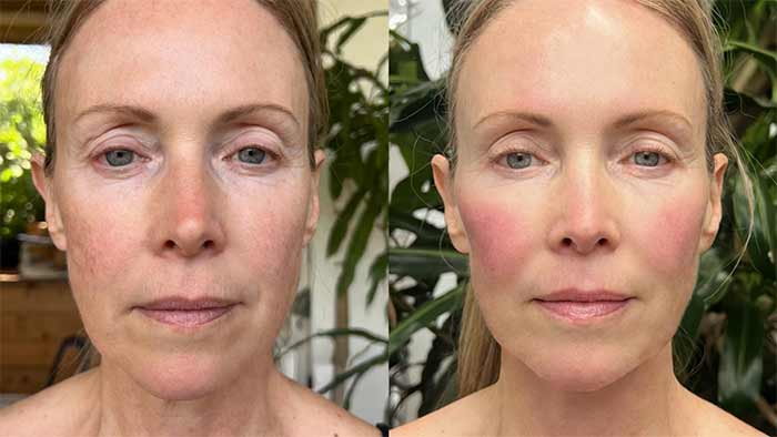 یوگای صورت برای گونه‌گذاری